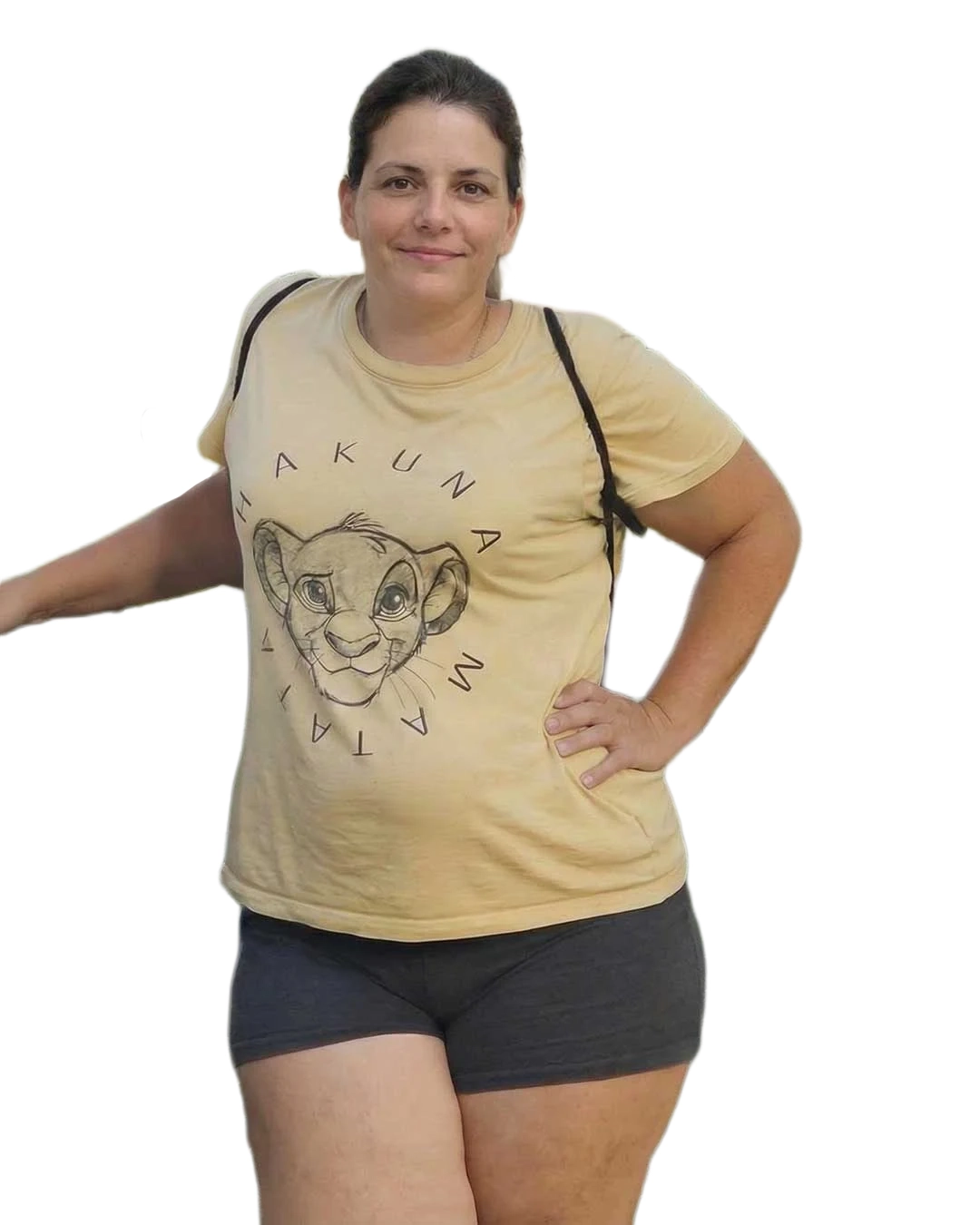 Antes del tratamiento GLP-1