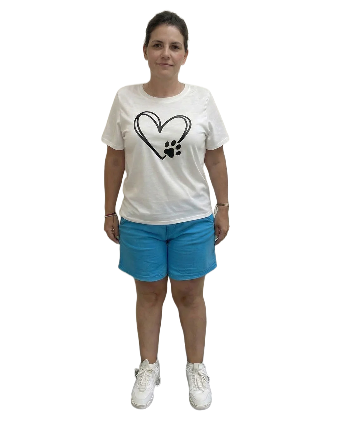 Después del tratamiento GLP-1