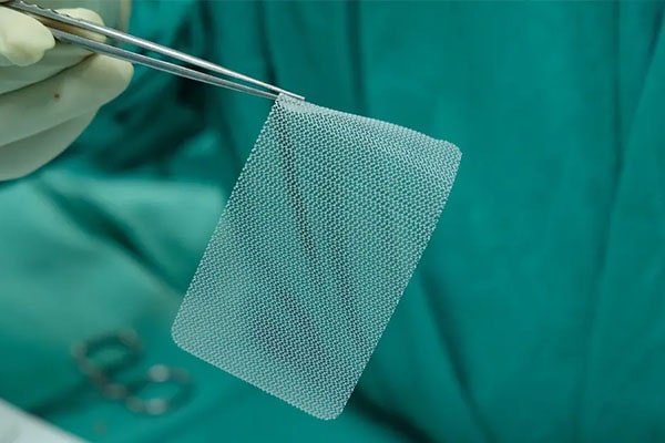 Malla quirúrgica utilizada en la reparación de hernias